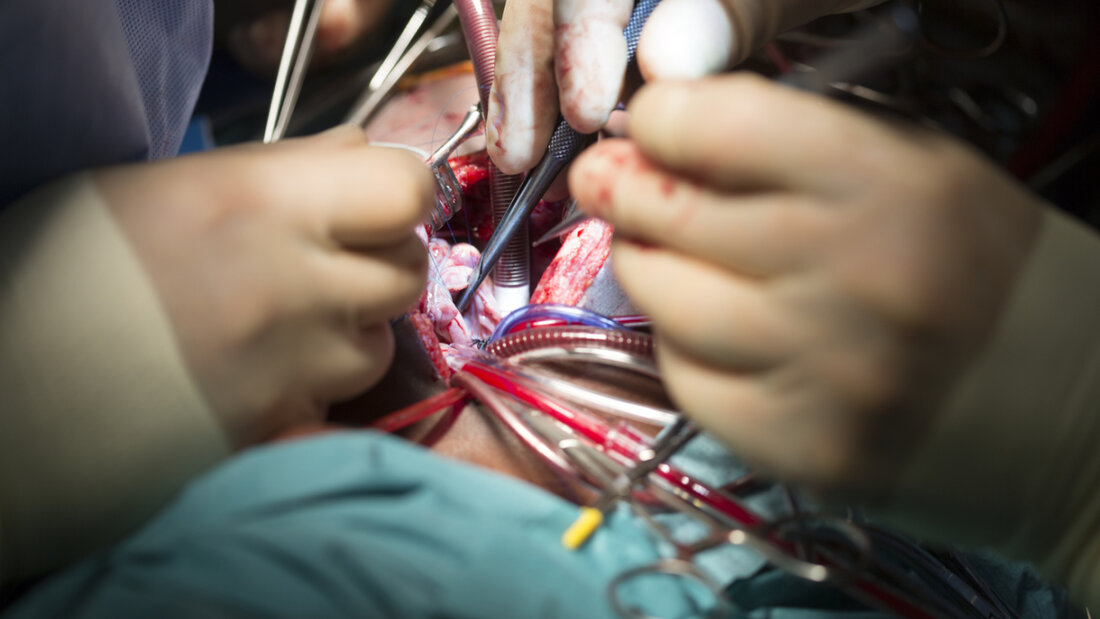 Pascal Meier hätte Chefarzt der Kardiologie werden sollen am Kantonsspital Aarau. Wegen öffentlicher Kritik tritt er seine Stelle nun nicht an. (Symbolbild) 20260513102708380.jpg