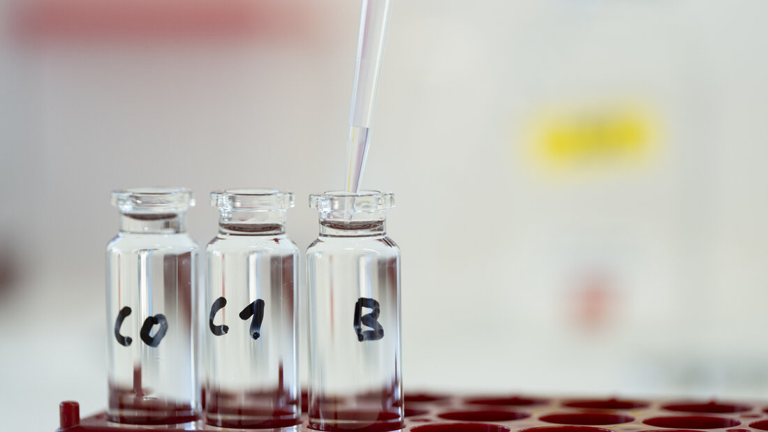 Wird zu sehr nach PFAS-Rückständen gesucht? Die bürgerlichen Fraktionen wollen weniger Tests durch das Amt für Umwelt. (Archivbild) 20261002162949929.jpg