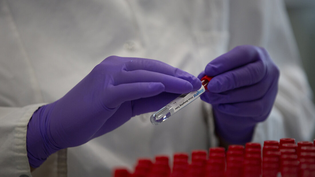 Der US-Pharma- und Medizintechnikkonzern Johnson & Johnson ist seit über 60 Jahren in der Schweiz vertreten und hat derzeit neun Standorte. (Archivbild) 20250107214523290.jpg