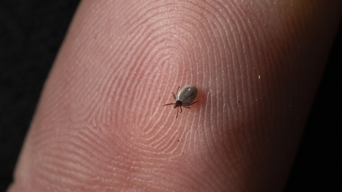 Sie sind klein und verbreiten Unbehagen: Eine Zecke auf dem Finger einer Person. (Archivbild) 20260424152206787.jpg