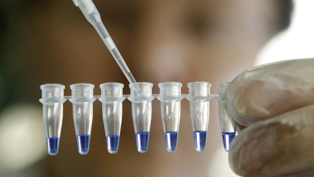 Ein Chemiker demonstriert 2009 in einem Labor in Stuttgart die Vorgehensweise bei einer DNA-Analyse. Diese neuen Möglichkeiten für Ermittler brachten 2019 den Kanton St. Gallen dazu, in einer Standesinitiative die Unverjährbarkeit von Mord zu fordern. 20260916093537937.jpg