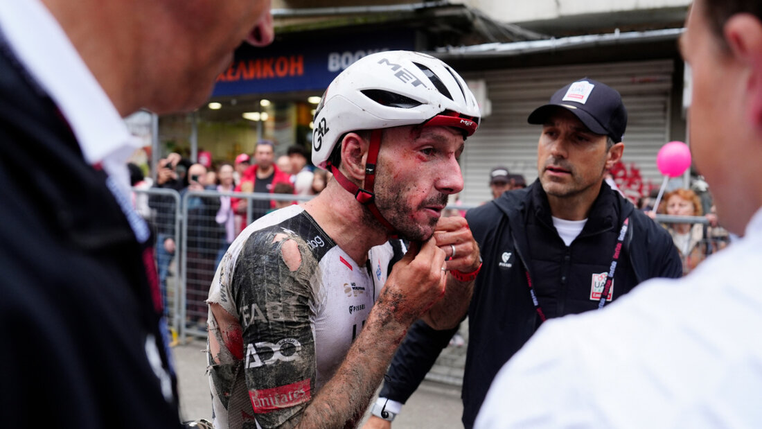 Gezeichnet vom schweren Sturz: Adam Yates im Ziel der 2. Etappe 20260510113836291.jpg