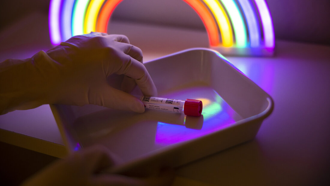 Eine städtische Initiative verlangte Gratistests auf sexuell übertragbare Krankheiten für gewisse Bevölkerungsgruppen der Stadt St. Gallen. (Archivbild) 20251130142137225.jpg