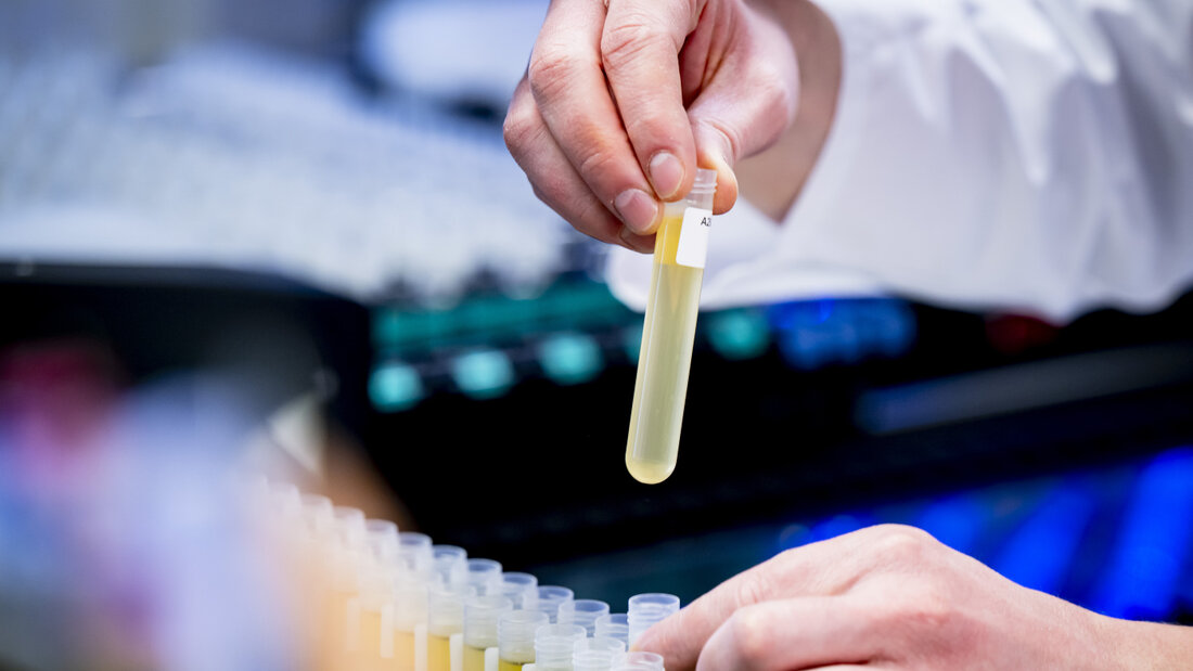 Die Polizei hat in Pratteln BL 3200 Injektionsflaschen mit illegal importierten Peptiden gefunden. Wer solche Produkte im Sport anwendet, riskiert einen Verstoss gegen Anti-Doping-Bestimmungen. (Symbolbild) 20261007141843081.jpg